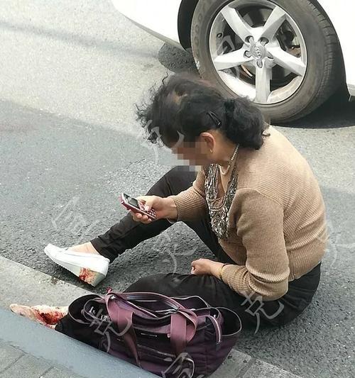 跑步机压伤怎么办（应对跑步机压伤的有效方法）