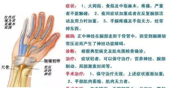 半夜手指麻木怎么回事？可能的原因有哪些？