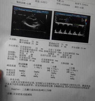 心动过速发作时如何自救？分享有效的自救动作步骤！
