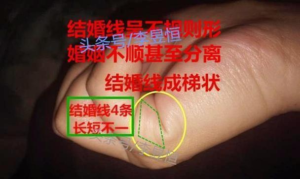 婚姻不顺利的原因有哪些？如何解决婚姻中的问题？