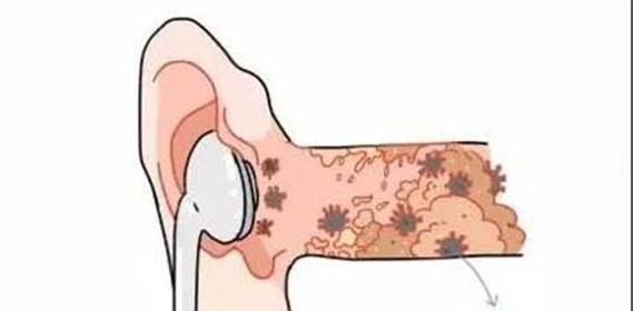 耳机有异味的解决方法？如何预防耳机产生异味？